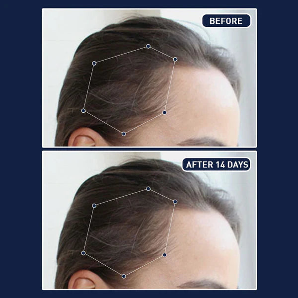 🎁Today's Offer: 65% off on FEG™ Hair Growth Spray
