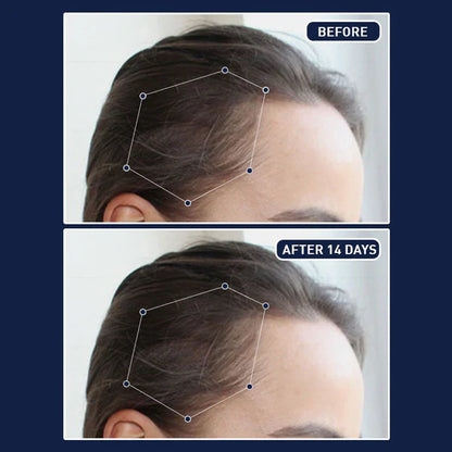 🎁Today's Offer: 65% off on FEG™ Hair Growth Spray