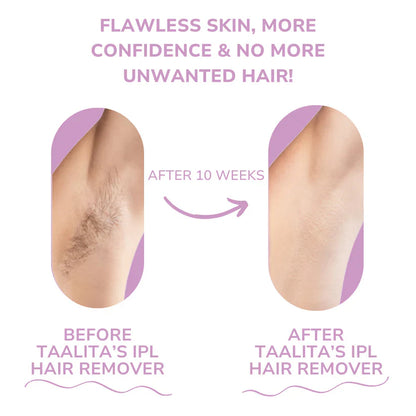 🎁 عرض اليوم - جهاز إزالة الشعر بالليزر 𝐁𝐞𝐚𝐮𝐭𝐲𝐏𝐥𝐮𝐬 𝐈𝐏𝐋 I الرائد في إزالة الشعر بالليزر