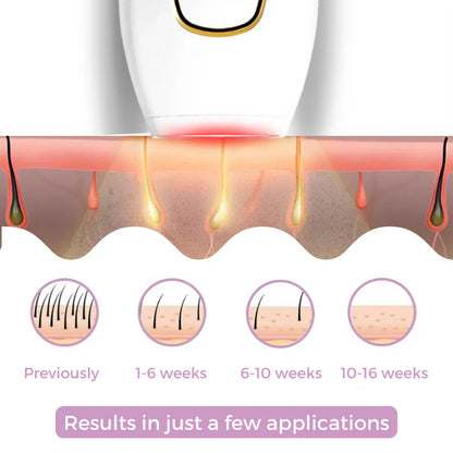 🎁 عرض اليوم - جهاز إزالة الشعر بالليزر 𝐁𝐞𝐚𝐮𝐭𝐲𝐏𝐥𝐮𝐬 𝐈𝐏𝐋 I الرائد في إزالة الشعر بالليزر