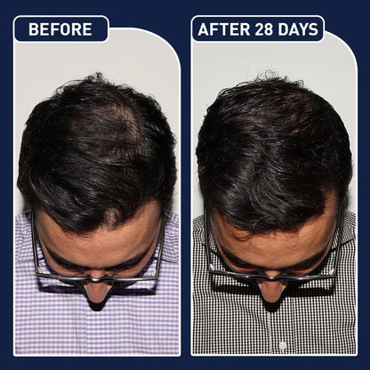 🎁Today's Offer: 65% off on FEG™ Hair Growth Spray