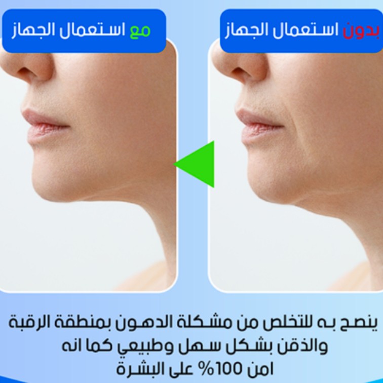 Skin tightening and sculpting, skin firming, wrinkle and double chin removal