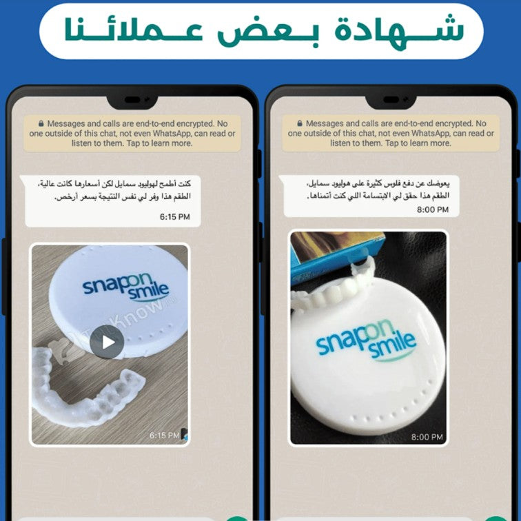 Snap - On Smile ابتسامة مثالية في ثوانٍ