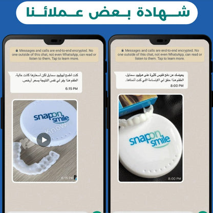 Snap - On Smile ابتسامة مثالية في ثوانٍ