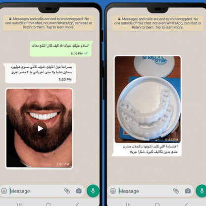 Snap - On Smile ابتسامة مثالية في ثوانٍ