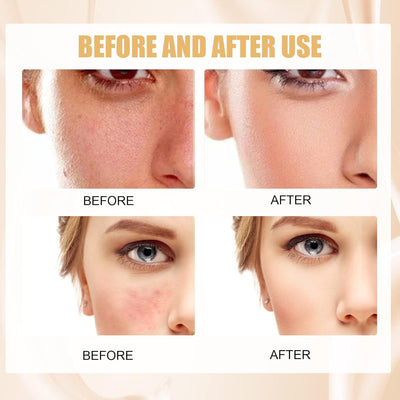 EELHOE - Foundation Make - Up