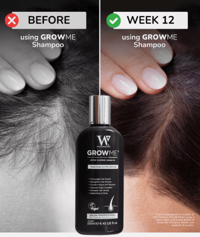 Hair Growth Shampoo