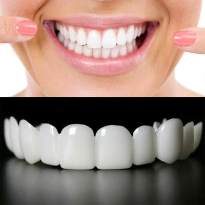 Snap On Smile - Snap On Smile