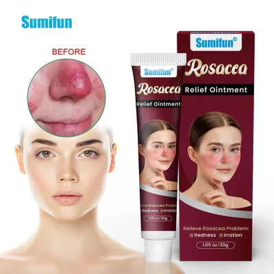 Sumifun - Rosacca Relief Ointment